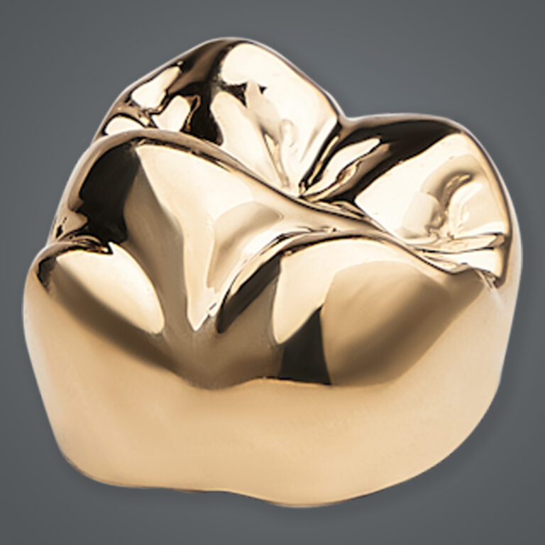 Full Cast Gold Crown